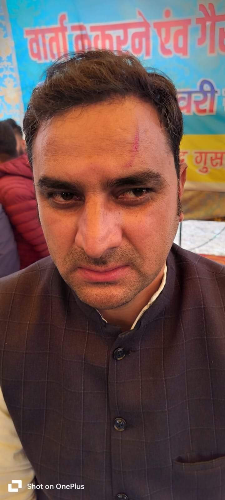 उपनल कर्मचारियों का हल्ला बोल