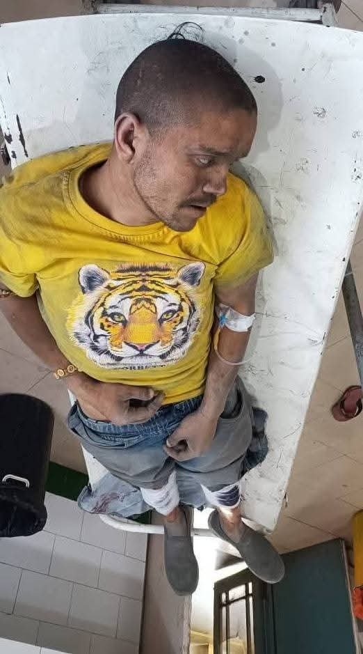 बिरजू मयाल पर हमला सुशीला तिवारी अस्पताल रेफर